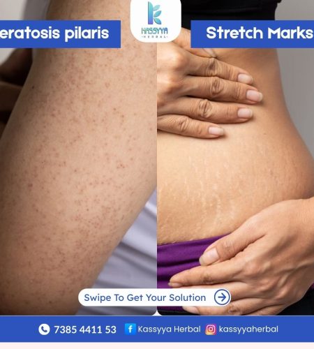 WhatsApp Image 2025-07-29 at 1.51.13 PM (2)