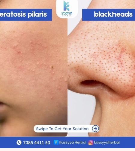 WhatsApp Image 2025-07-29 at 1.51.14 PM